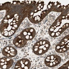 Immunohistochemical staining of human rectum shows strong cytoplasmic positivity in glandular cells.