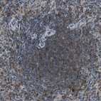 Anti-NMI Antibody