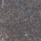 Immunohistochemical staining of human tonsil shows moderate cytoplasmic positivity in non-germinal center cells.