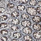 Immunohistochemical staining of human colon shows strong cytoplasmic positivity in glandular cells.