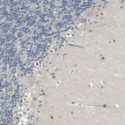 Immunohistochemical staining of human cerebellum shows no positivity in Purkinje cells as expected.