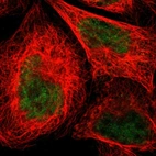 Immunofluorescent staining of human cell line A-431 shows localization to nucleoplasm & cytosol.