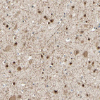 Immunohistochemical staining of human cerebral cortex shows strong nuclear and cytoplasmic positivity in neurons.