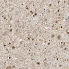 Immunohistochemical staining of human cerebral cortex shows strong nuclear and cytoplasmic positivity in neurons.