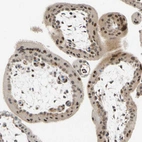 Immunohistochemical staining of human placenta shows moderate nuclear cytoplasmic positivity in trophoblastic cells.