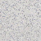 Immunohistochemical staining of human liver shows no positivity in hepatocytes as expected.
