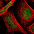Immunofluorescent staining of human cell line U-2 OS shows localization to nucleoplasm.