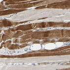 Anti-ZNF236 Antibody