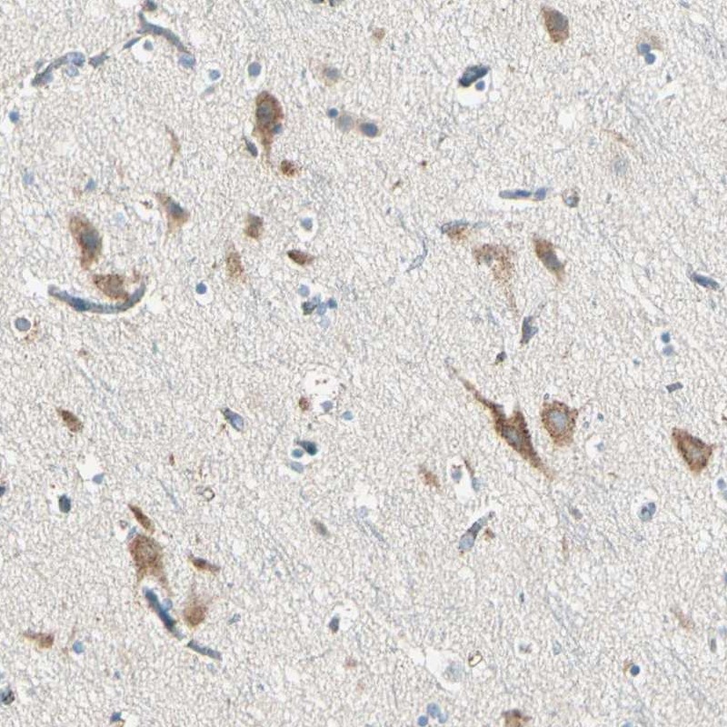 Anti-SLC6A15 Antibody