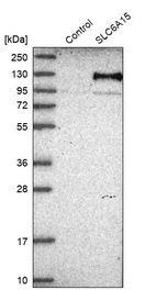 Anti-SLC6A15 Antibody