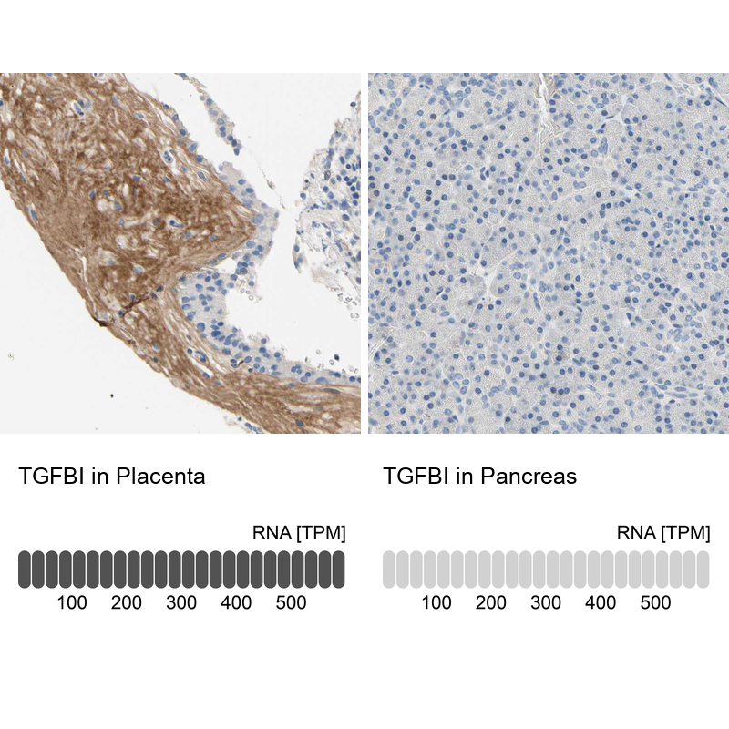 Anti-TGFBI Antibody