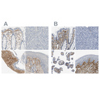 Immunohistochemical staining of human gastrointestinal, pancreas, placenta and skin using Anti-TGFBI antibody HPA008612 (A) shows similar protein distribution across tissues to independent antibody HPA017019 (B).