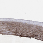 Immunohistochemical staining of human eye shows moderate extracellular positivity in cornea.