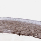 Immunohistochemical staining of human eye shows moderate extracellular positivity in cornea.