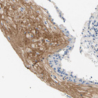 Immunohistochemical staining of human placenta shows moderate positivity in extracellular matrix of trophoblastic cells.