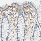 Immunohistochemical staining of human gastrointestinal shows moderate positivity in extracellular matrix of glandular cells.