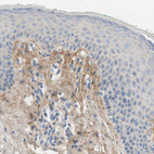 Immunohistochemical staining of human skin shows moderate positivity in extracellular matrix of dermis.