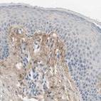 Immunohistochemical staining of human skin shows moderate positivity in extracellular matrix of dermis.