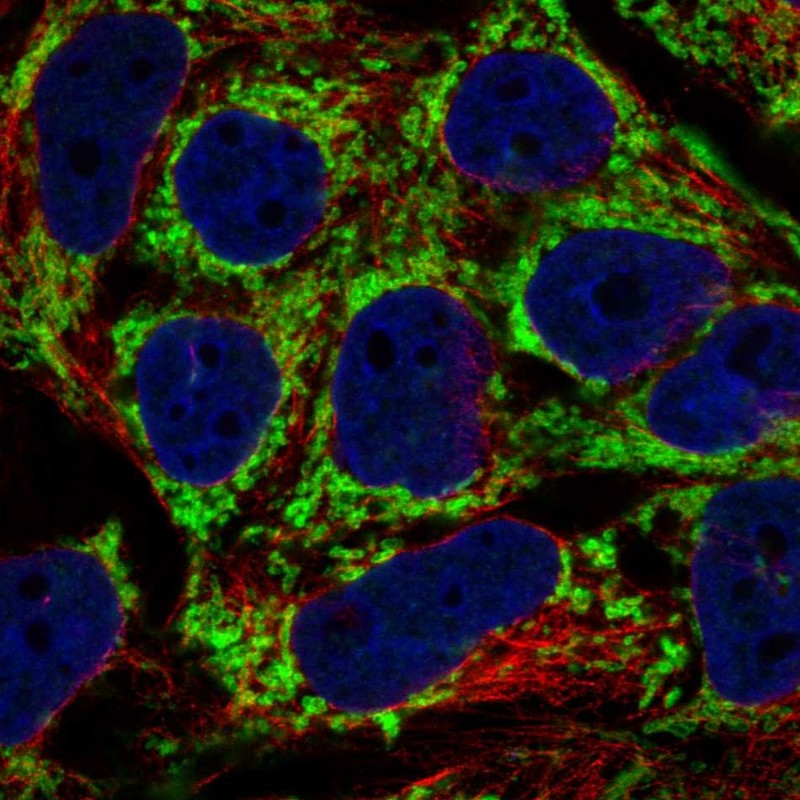 Anti-AKAP1 Antibody