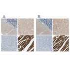 Immunohistochemical staining of human cerebellum, cerebral cortex, pancreas and skeletal muscle using Anti-CACNA2D1 antibody HPA008621 (A) shows similar protein distribution across tissues to independent antibody HPA008213 (B).
