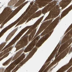 Immunohistochemical staining of human skeletal muscle shows strong cytoplasmic positivity in myocytes.