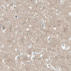 Immunohistochemical staining of human cerebral cortex shows weak positivity in neuropil.