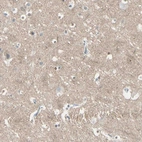 Immunohistochemical staining of human cerebral cortex shows weak positivity in neuropil.