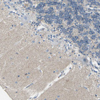 Immunohistochemical staining of human cerebellum shows moderate positivity.