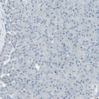 Immunohistochemical staining of human pancreas shows no positivity in exocrine glandular cells as expected.