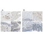 Immunohistochemical staining of human cervix, uterine, skeletal muscle, skin and small intestine using Anti-CPA3 antibody HPA008689 (A) shows similar protein distribution across tissues to independent antibody HPA006479 (B).