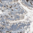 Immunohistochemical staining of human small intestine shows strong cytoplasmic positivity in mast cells.