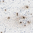 Immunohistochemical staining of human cervix, uterine shows strong cytoplasmic positivity in mast cells.