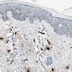 Immunohistochemical staining of human skin shows strong cytoplasmic positivity in mast cells.