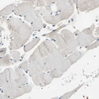 Immunohistochemical staining of human skeletal muscle shows no positivity in myocytes as expected.