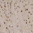 Immunohistochemical staining of human cerebral cortex shows moderate to strong cytoplasmic positivity in neurons.