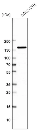 Western blot analysis in human cell line SCLC-21H.