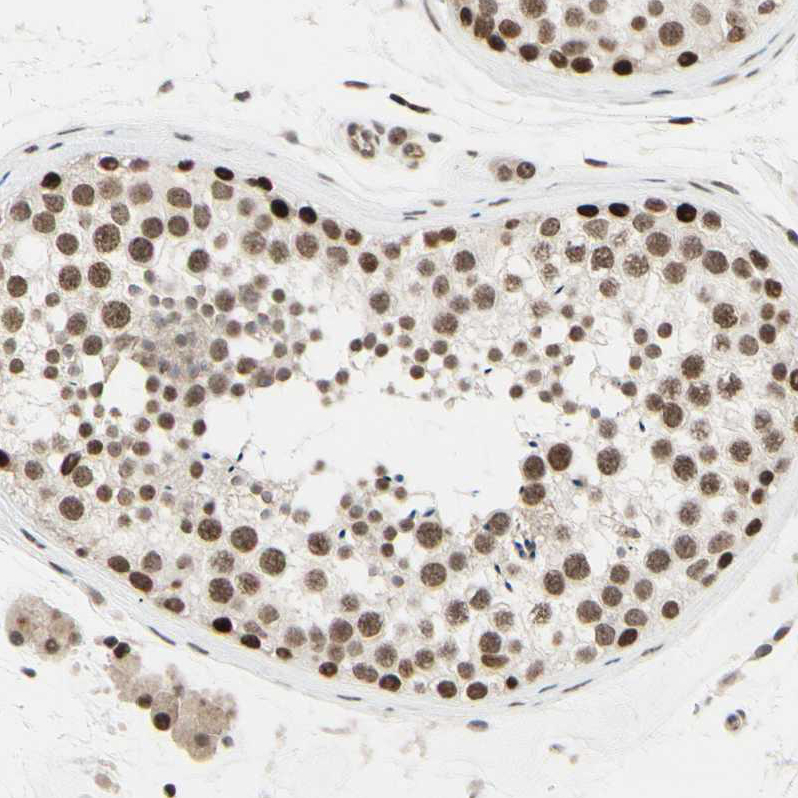 Anti-SUFU Antibody
