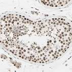 Anti-SUFU Antibody
