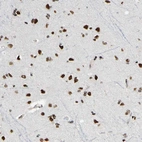 Immunohistochemical staining of human Cerebral cortex shows strong nuclear positivity in neuronal and glial cells.