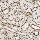 Immunohistochemical staining of human Kidney shows strong nuclear positivity in cells in tubules.