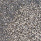 Immunohistochemical staining of human Tonsil shows moderate nuclear positivity in germinal and non-germinal center cells.