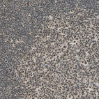 Immunohistochemical staining of human Tonsil shows moderate nuclear positivity in germinal and non-germinal center cells.