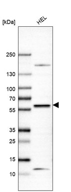 Western blot analysis in human cell line HEL.