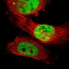 Immunofluorescent staining of human cell line U-251 MG shows localization to nucleus.