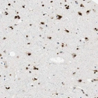 Immunohistochemical staining of human Cerebral cortex shows strong nuclear positivity in neuronal and glial cells.