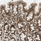 Immunohistochemical staining of human Colon shows strong nuclear positivity in glandular cells.