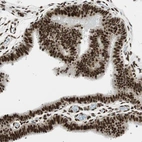 Immunohistochemical staining of human Fallopian tube shows strong nuclear positivity in glandular cells.