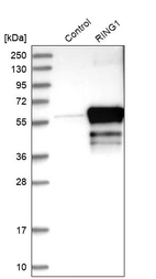 Western blot analysis in control (vector only transfected HEK293T lysate) and RING1 over-expression lysate (Co-expressed with a C-terminal myc-DDK tag (~3.1 kDa) in mammalian HEK293T cells, LY401023).