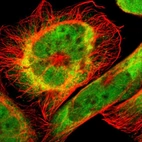 Immunofluorescent staining of human cell line A-431 shows localization to nucleoplasm & cytosol.