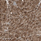 Anti-EVC Antibody